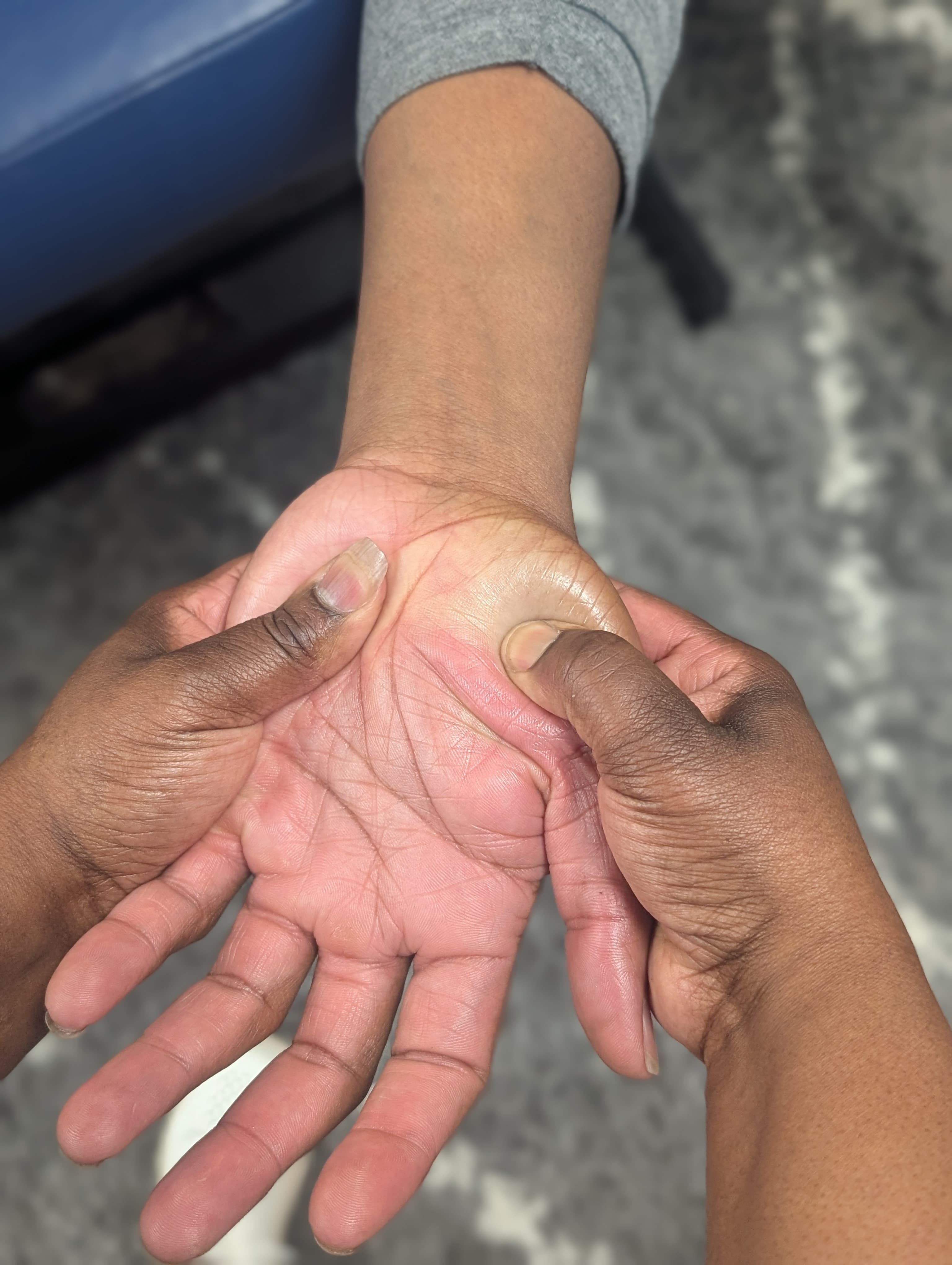 Hand reflexology at Knot Me — reflex zones in the hands